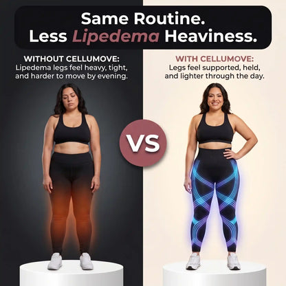 Cellumove USA 3D Legging – Say goodbye to lipoedema pain and swelling naturally